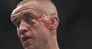 MMA Injuries